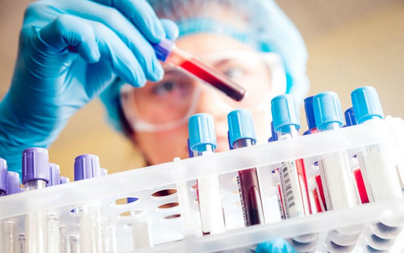 Anti-streptolizin-O Nədir?